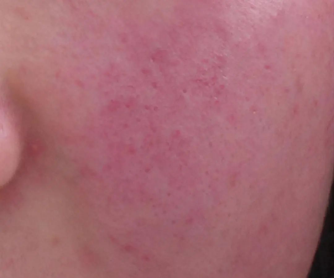 2f4a61105455e494287fda3580a92433.jpeg