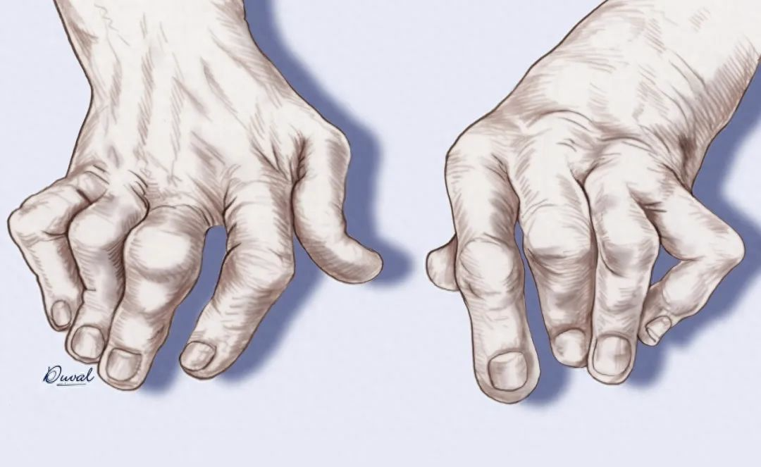 fe68d33ce5ff0297df0d31a8579502bd.png