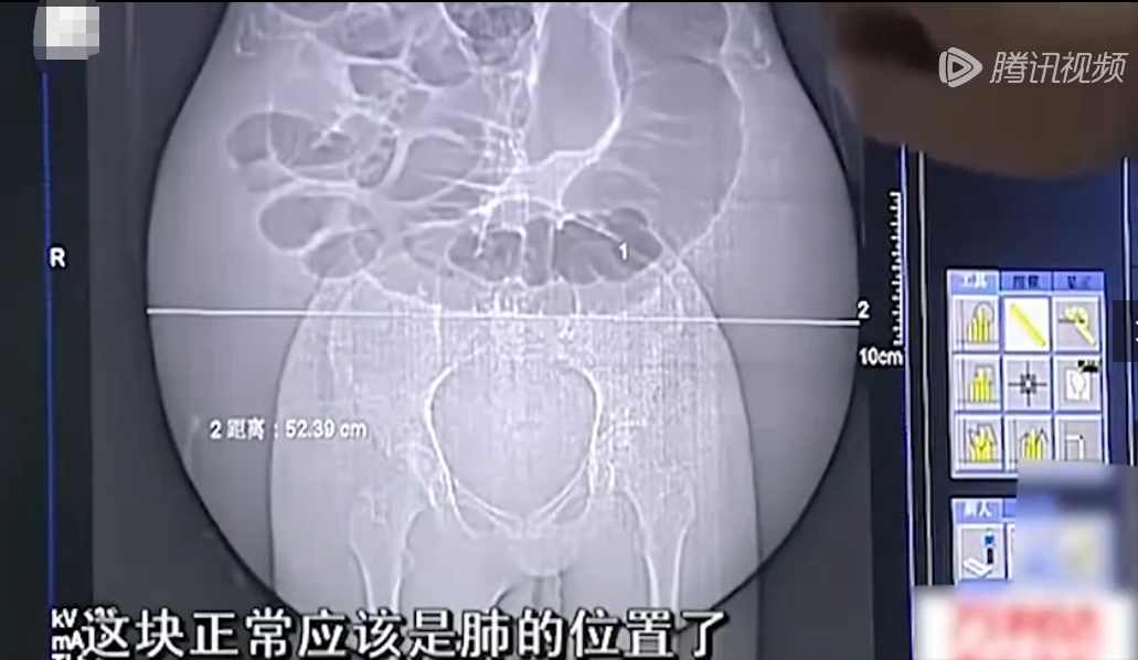 98e6a86f9757b4651cbe55d24db3823f.png