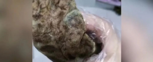 女子产后体内遗留纱布！当地卫健委回应：助产士失误，已被暂停执业 ...