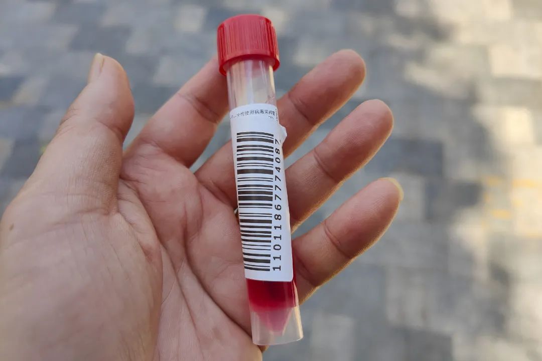 不小心沾到病毒采样管里红红的液体，会有事吗？