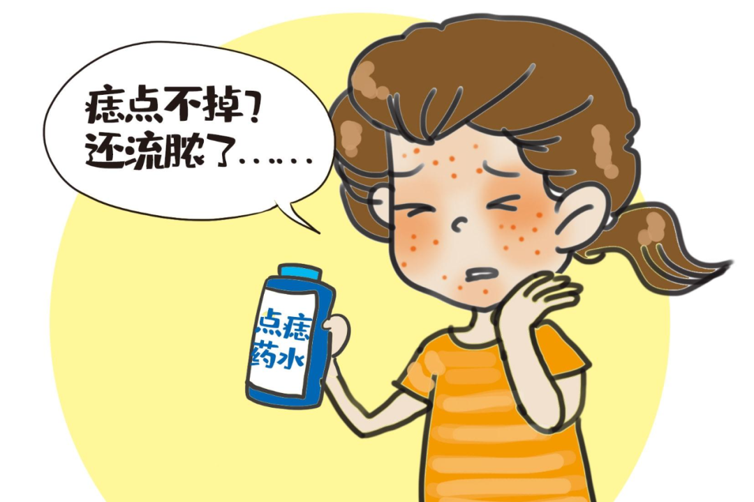 网红药水一擦，脸上的痣就没了？医生郑重提醒！