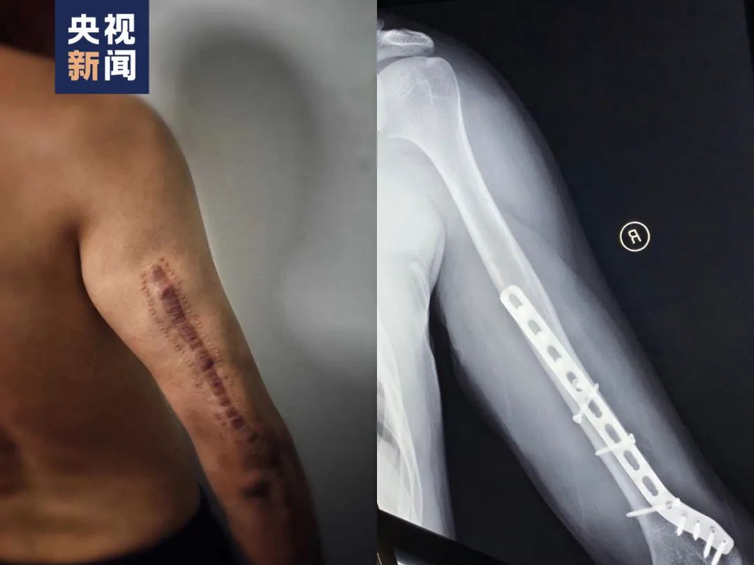 小说被批歌颂毒枭爱情！不能让英雄流血再寒心！