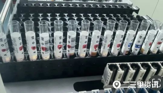 极其罕见！此地发现1例黄金血型