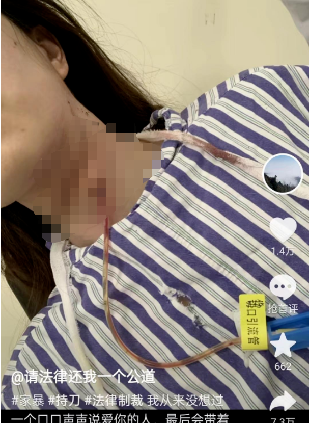 女子发布视频称被丈夫割喉，当地妇联：已介入