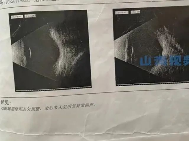 冲上热搜！1岁宝宝近视600度，最坏的结果可能失明......原因与父母有关？ ...