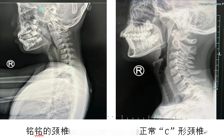 “孩子才9岁，这里老化得像50岁！”