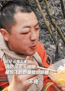 “眼睛疼吗？”“不疼，就是有点睁不开”