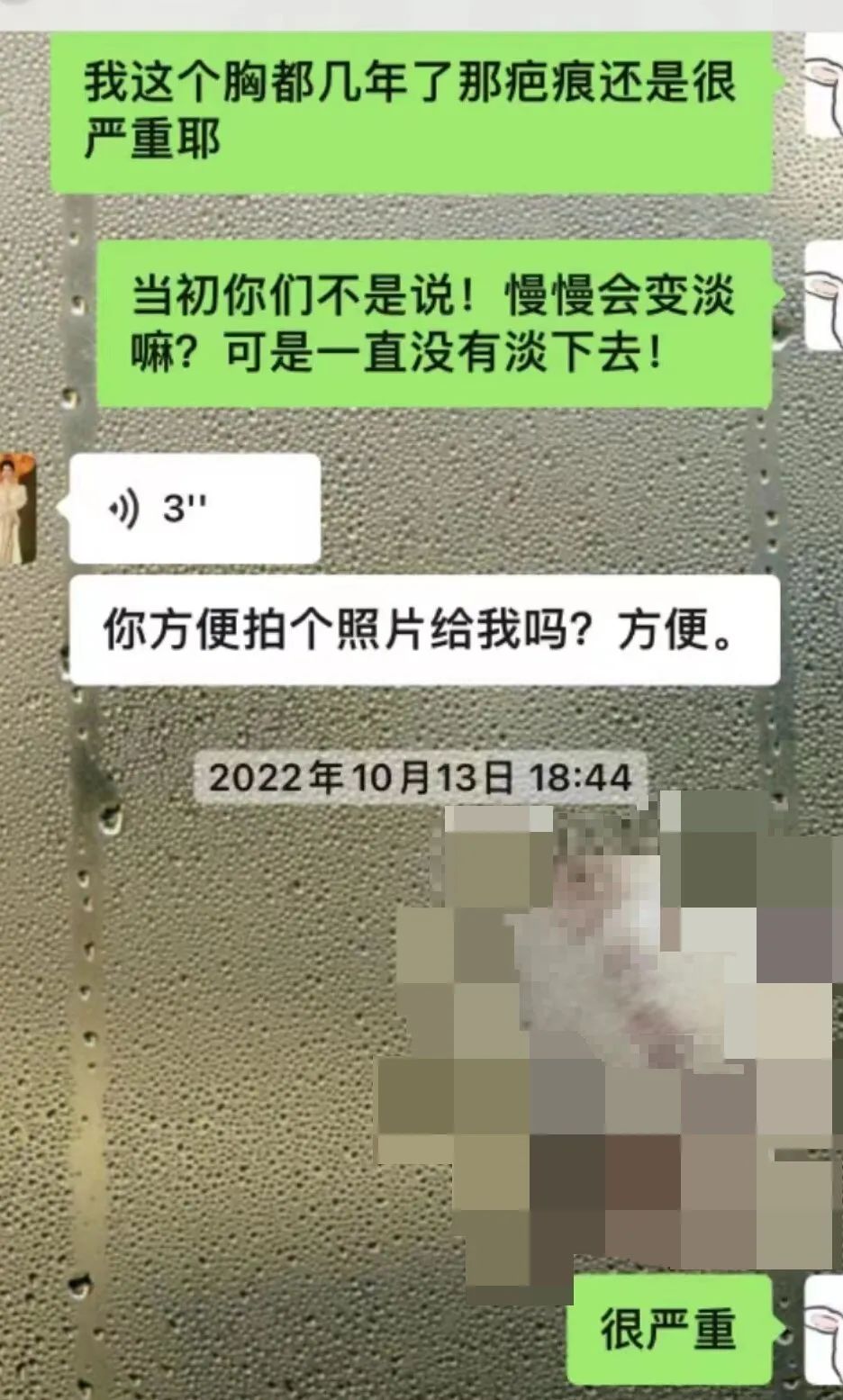 丰胸4年后仍留疤痕，女子称“自卑不敢面对老公”，回应：将协商 ... ...