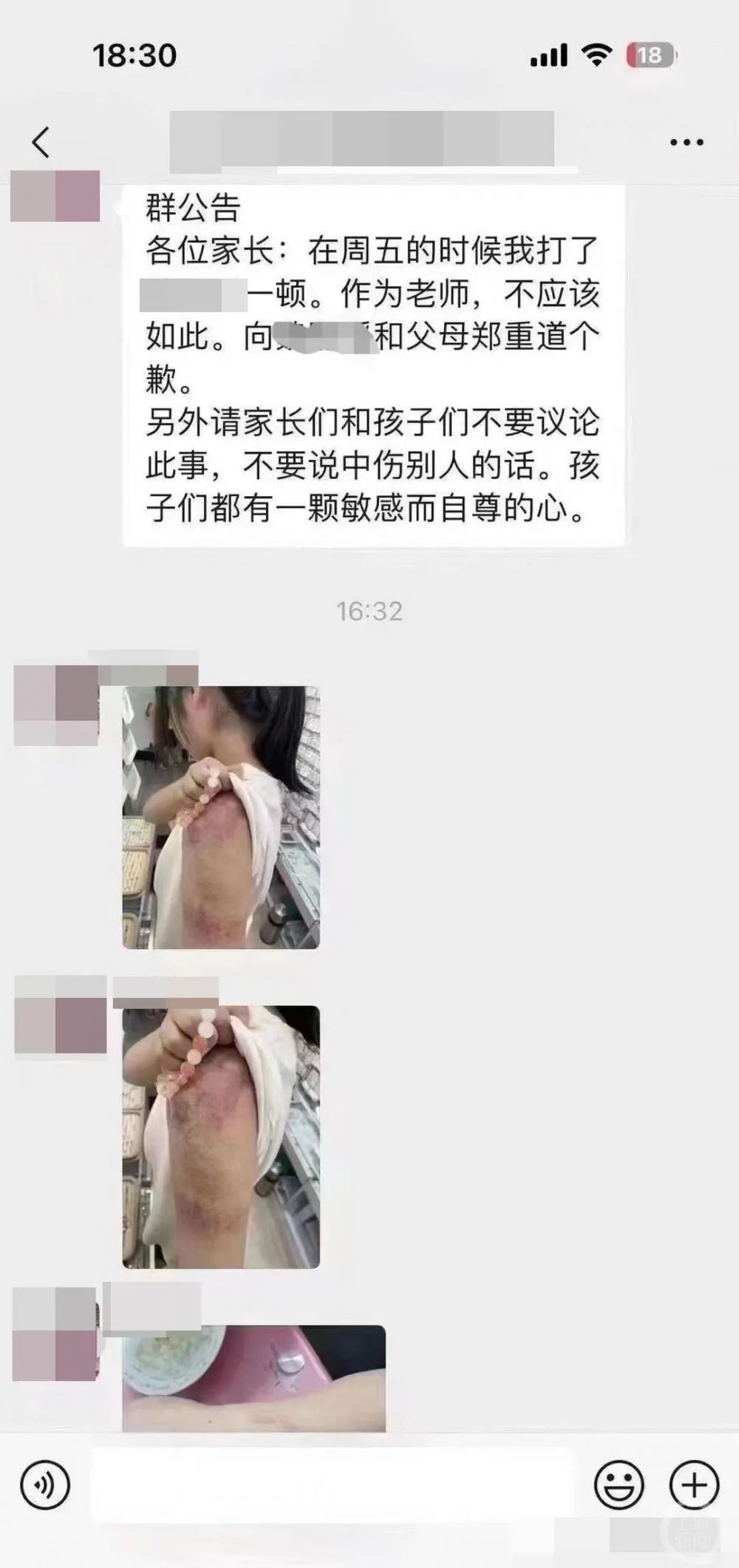 老师体罚学生后道歉获其他家长安慰，教育局：责令解聘！
