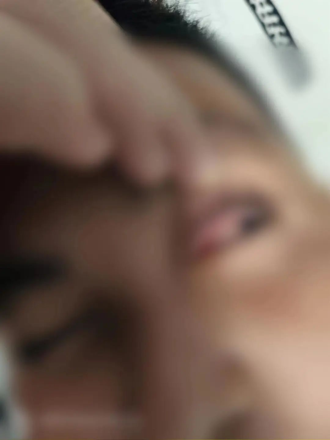 多名孩子在夏令营染上红眼病！卫生部门：正进行流调