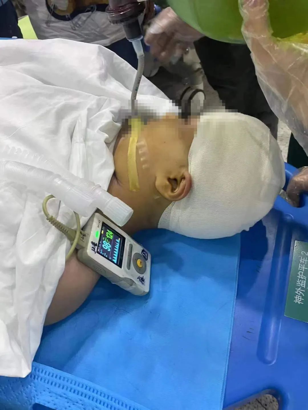 被打破头骨的女孩回忆事发细节：老师故意击打2次！做噩梦哭喊“别打我” ... ...