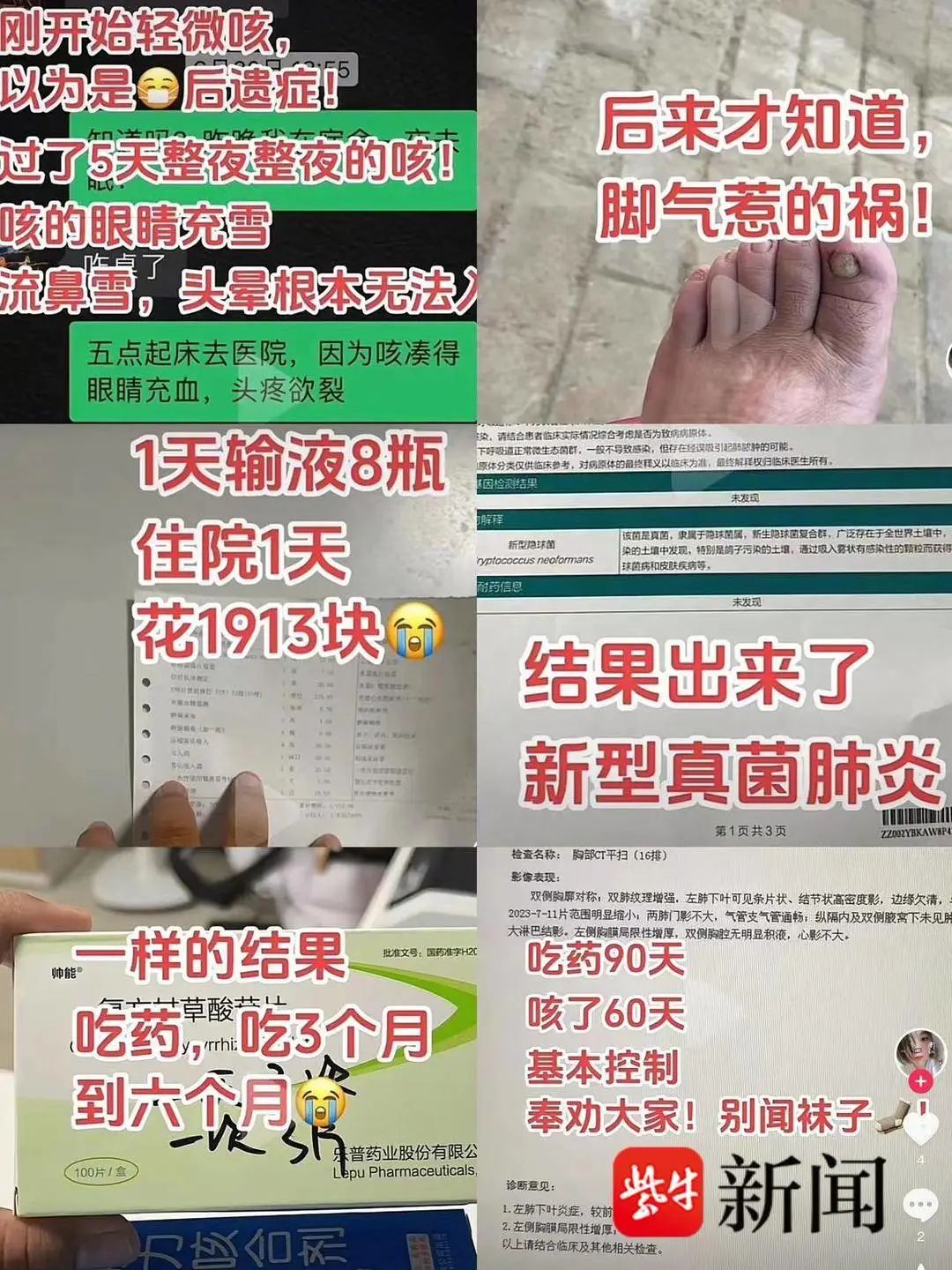 闻了刚脱下的臭袜子，她竟感染真菌肺炎