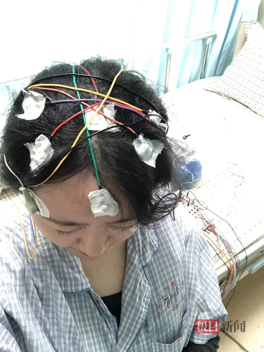 困在睡眠中的罕见病患者：被嘲为“睡神”有口难辩