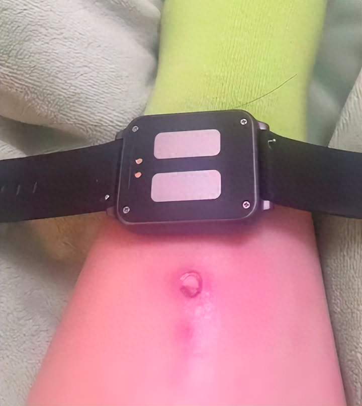 考研女生为起床戴电击闹钟，电破皮……没醒