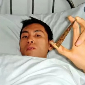 云南女子给丈夫按摩，导致丈夫吐血，检查发现头部有把10厘米尖刀 ... ... ... ...