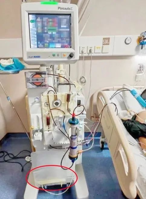管不住嘴惹的祸！深圳男子体内滤出400毫升“黄油”
