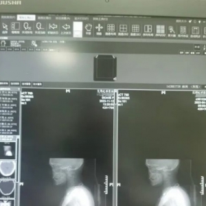 一张CT片子套多个病历！医生实名举报无锡虹桥医院涉嫌骗保→ ... ... ... ...