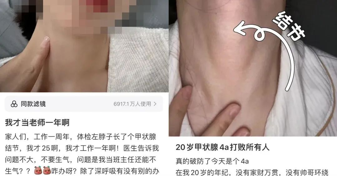 “每天摸800遍脖子，感觉被判了无期……”95后姑娘得病崩溃，医生提醒→ ... ... ...