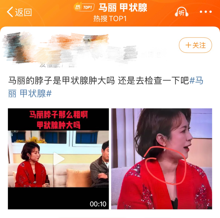 知名女星春晚登场，网友却喊话：快去医院检查！