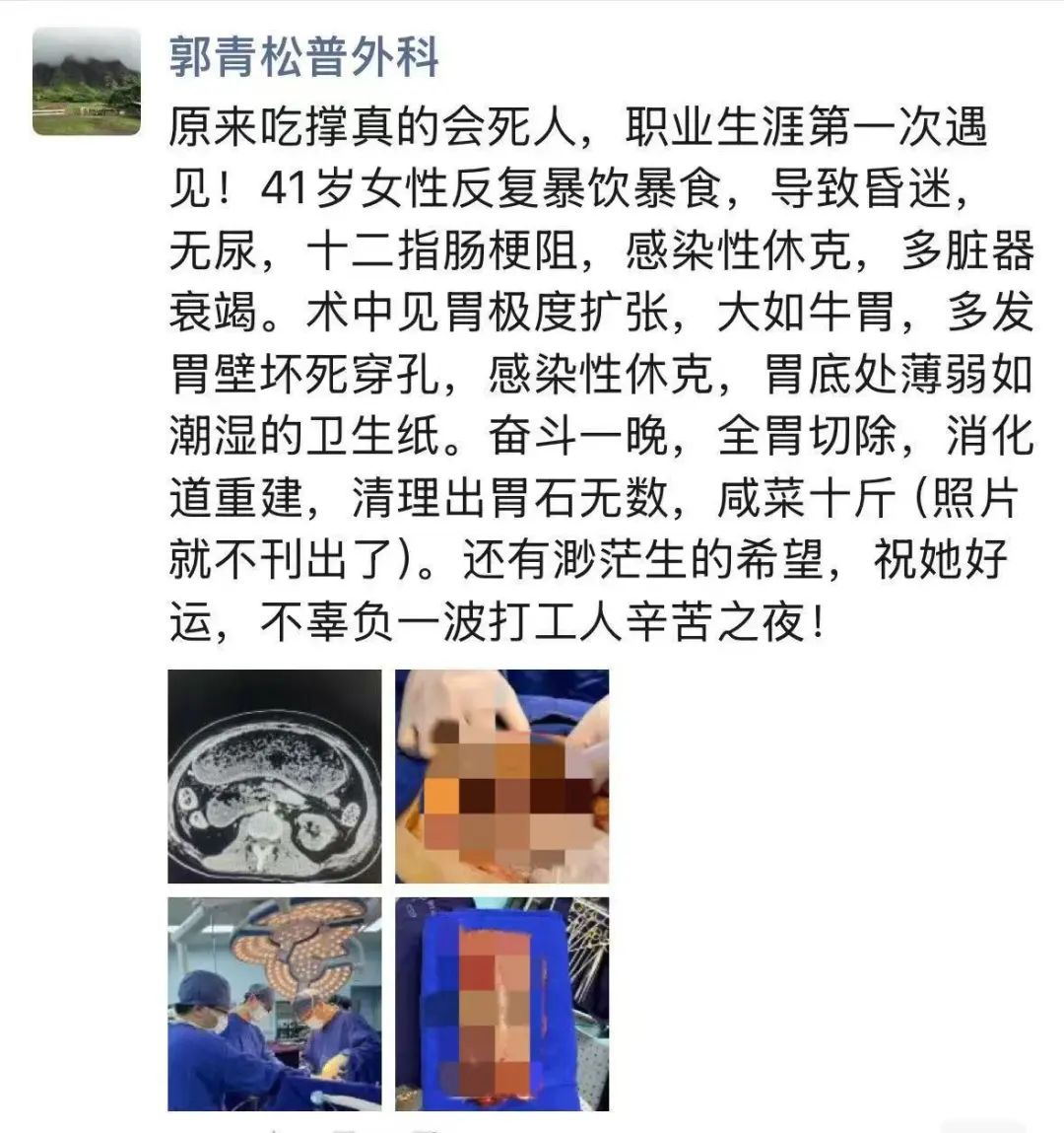 女子整个胃被摘除，清理出10斤这东西！主刀医生都惊了：“职业生涯第一次见” ... ...