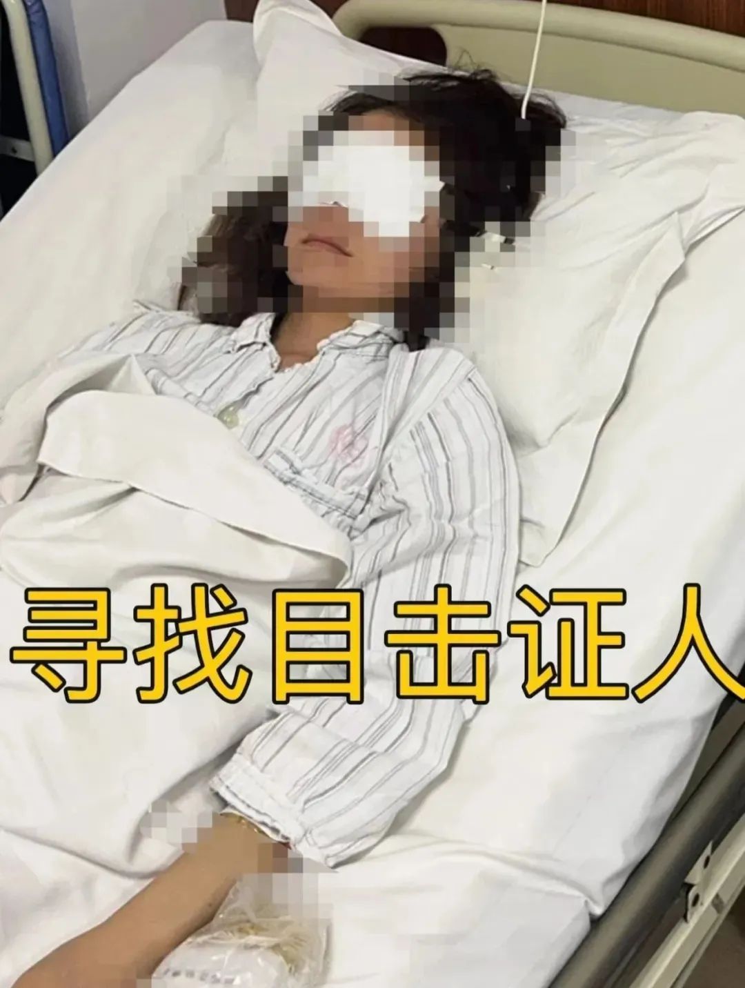 6月9日，一位女孩在社交媒体网站发帖，表示她在山东一个景区玩漂流时，被人用高压水枪打伤一只眼睛，当时就导致失明。医生表示她的右眼球挫伤，还有创伤性前房积血，伤情非常严重。她说肇事者打伤她的眼睛后逃走，现 ...