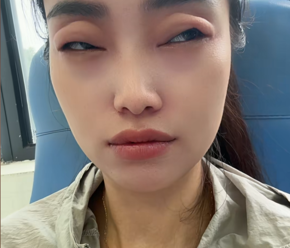 太夸张！女子仅吃了两颗，眼睛差点看不见！很多街坊爱吃...... ... ...