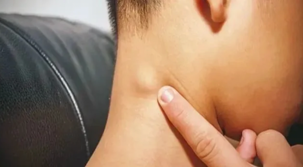 5岁男孩确诊已是晚期，癌细胞已转移……别忽视身上这种“小疙瘩”！ ...