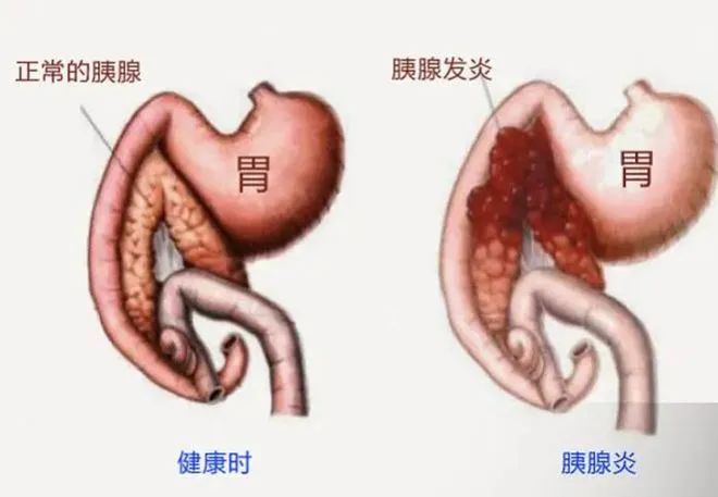 男孩腹部痛到抢救无效，仅仅48小时，父母称平时没什么病，医生看完饮食记录：任谁也扛 ...