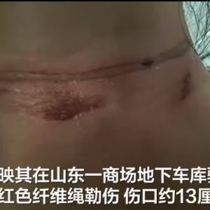山东一女子骑车进商场地库差点被“封喉”，伤口约13厘米！商场：入口处设有禁止非员工 ...
