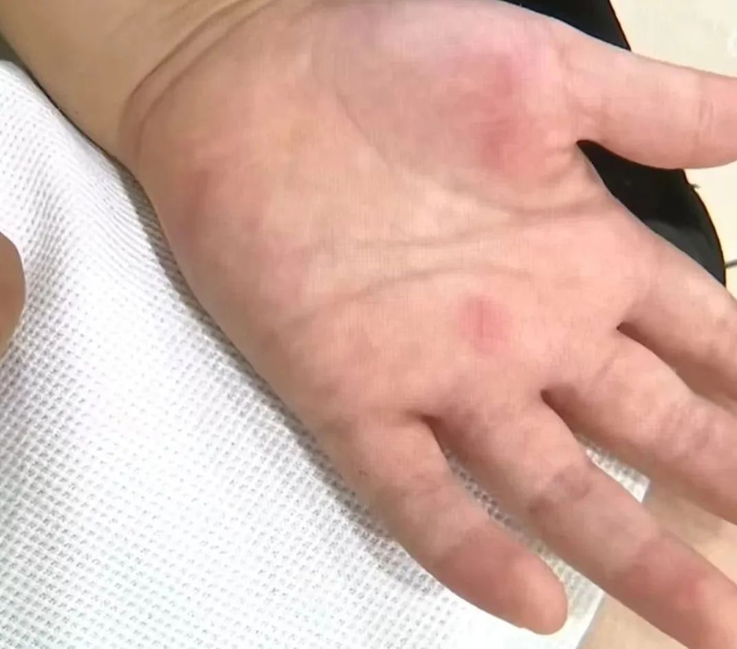 浙江一女子称4岁孩子玩娃娃机被电倒，医院诊断出心肌损害等，商家不承认漏电 ... ...