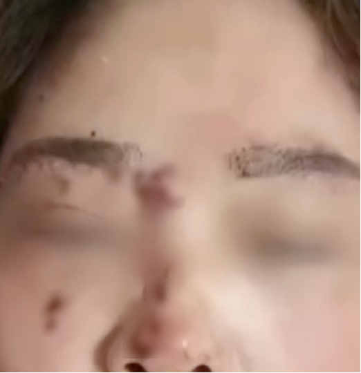 近日，湖南益阳刘女士发帖称，自己离婚5年后，在3月14日被前夫周某某追砍，致使全身多发性刀砍伤。当事人刘女士接受采访表示，此次事件发生在凌晨两点，前夫踹开房门，从厨房拿出菜刀砍向她，刘女士企图逃跑，被前夫 ...