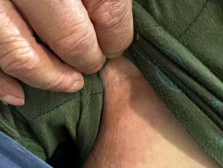 浙江男子被几百只蚂蚁围攻进抢救室！起因是家里的一堆“宝贝” ... ...