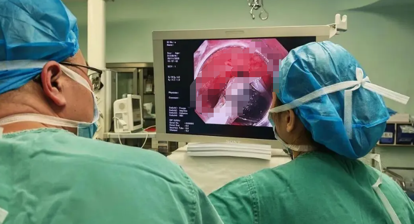 太猛了！男子酒后一冲动，30年后才想起来！医生惊呆...