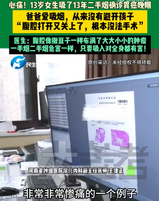 13岁女孩确诊胃癌晚期，爸爸常年吸烟从不避开孩子，医 ...