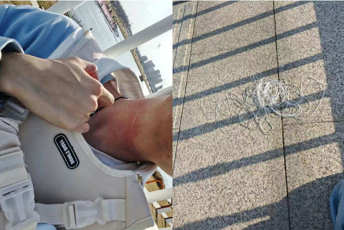 警惕！男子骑摩托过桥时被割脸，“凶器”又是它！