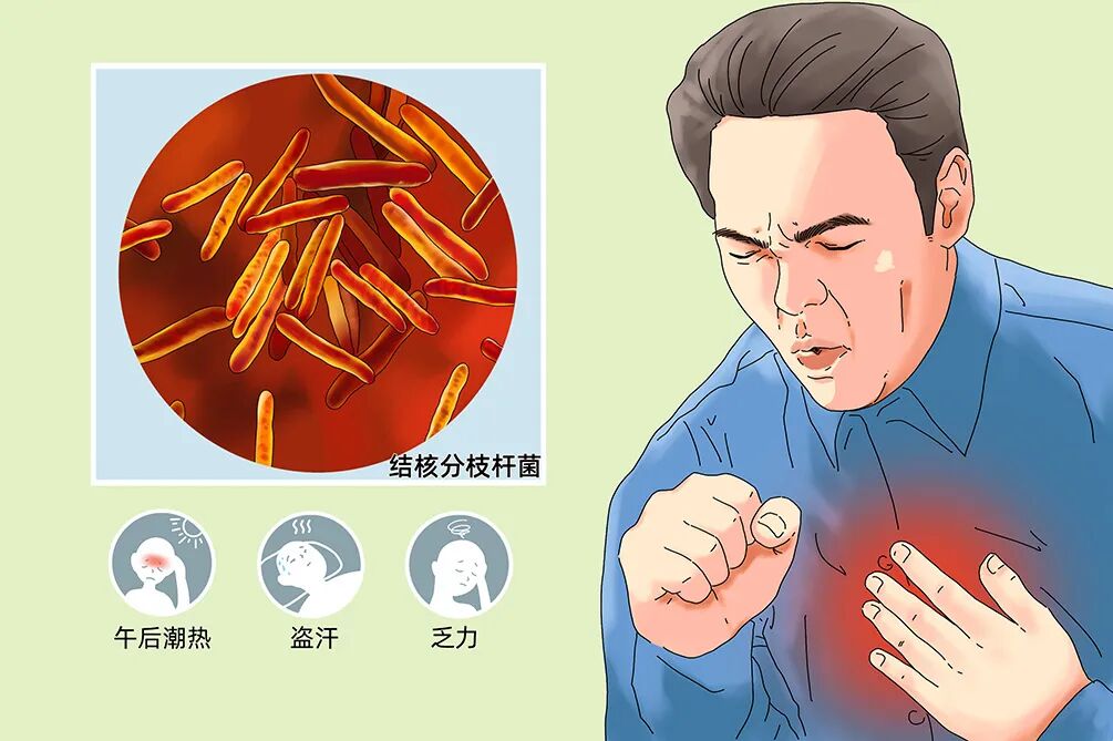 注意 | 久咳不愈千万别大意，当心这种病