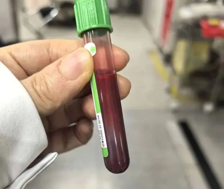 “快生了吃点好的没关系”，孕妇狂吃炸鸡汉堡，一周胖10斤，抽出“草莓牛奶”血，母婴 ...