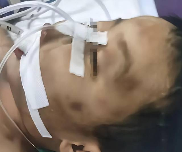 3岁男童遭生父女友虐死，细节曝光！赵雨蝶，被判死缓