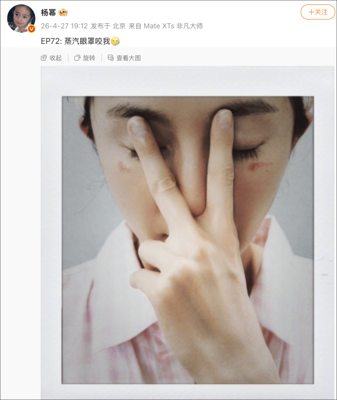 杨幂晒照，脸被蒸汽眼罩烫伤，网友：“我每次都是戴着睡觉，再也不敢了 ... ...