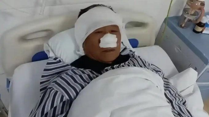 70岁老人与歹徒搏斗，鼻子被生生咬下吞进肚：最初没感觉，后来疼到差点昏迷 ... ... ...